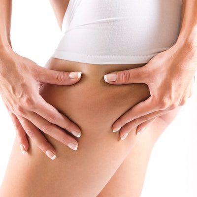 <strong>Cellulite</strong>