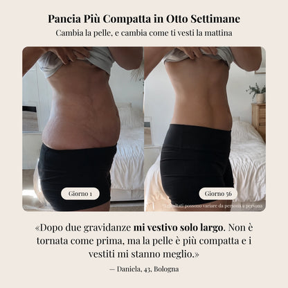 Prima e dopo pancia dopo 56 giorni, risultati di una cliente Allura Lab